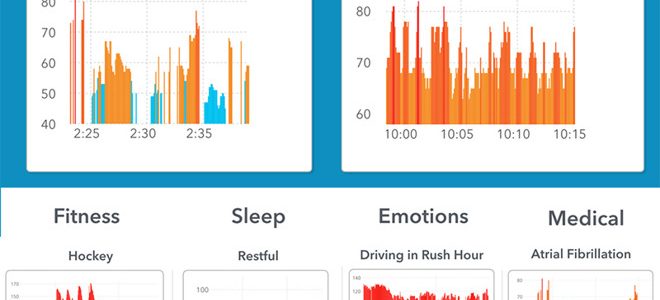 Apple Watch erkennt Herzrhythmusstörungen